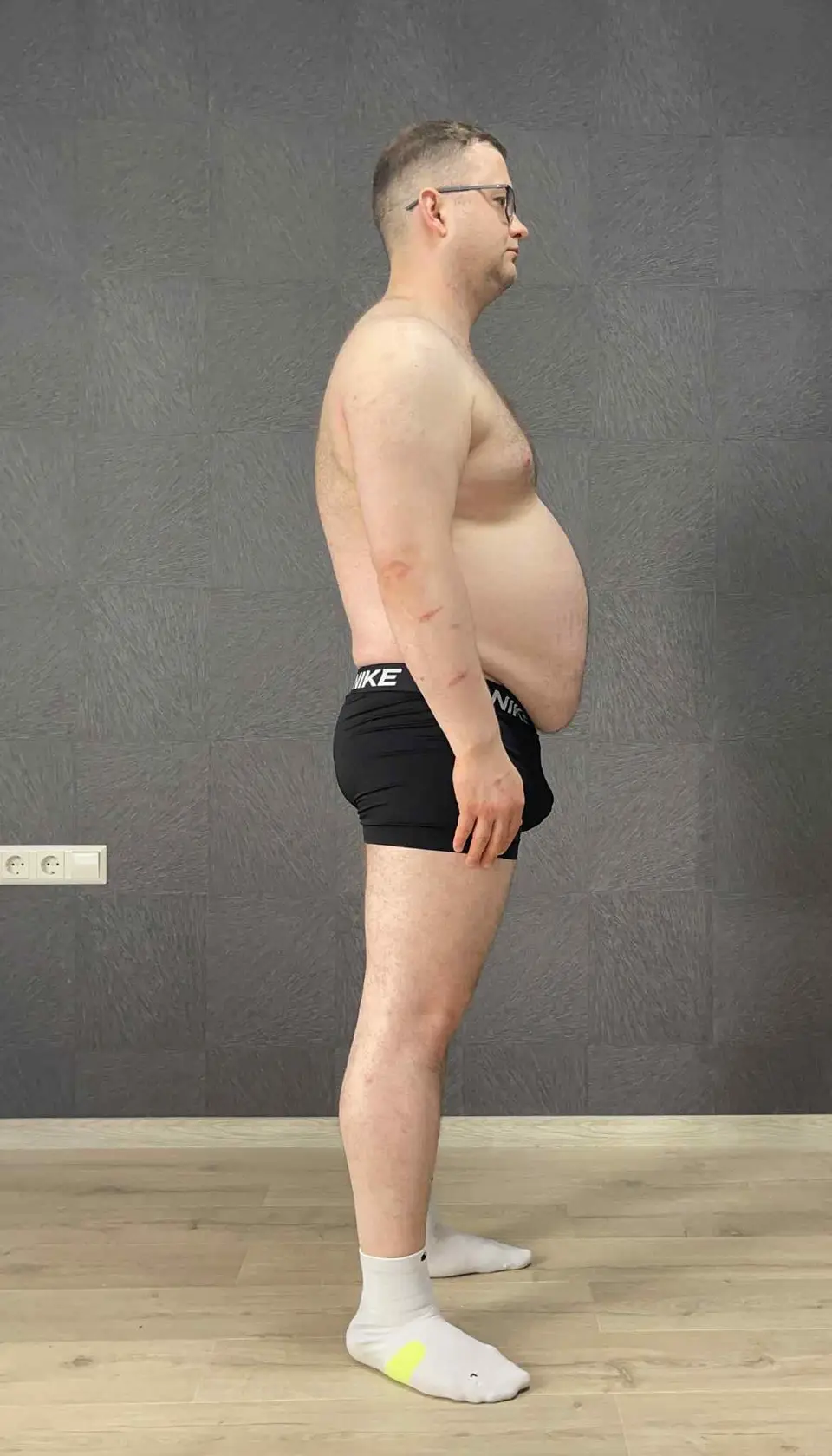 MIROSLAV MICHOLČ transformacijos foto prieš